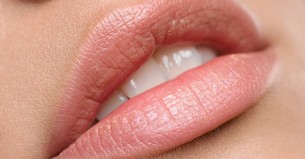 Labbra secche e screpolate: Come curarle!